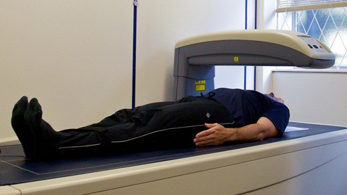 DEXA